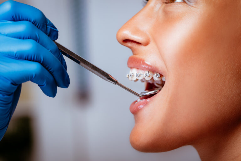 smiling woman at dentist 2023 11 27 05 15 37 utc