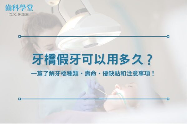 牙橋假牙可以用多久？一篇了解牙橋種類、壽命、優缺點和注意事項！